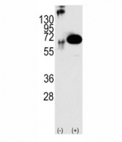 Western blot analysis of SHP2 antibody and 293 cell lysate either nontransfected (Lane 1) or transiently transfected with the PTPN11/SHP2 gene (2). Predicted molecular weight: ~68kDa.