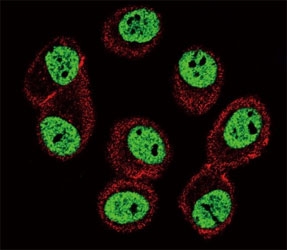 Confocal immunofluorescent analysis of BMI1 antibody with MCF-7 cells followed by Alexa Fluor 488-conjugated goat anti-rabbit lgG (green). Actin filaments have been labeled with Alexa Fluor 555 Phalloidin (red).