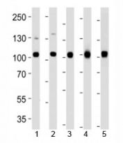 Western blot analysis of lysate from 1) MCF-7, 2) U251, 3) mouse NIH3T3, 4) rat C6 cell line and 5) mouse liver tissue using VCP antibody at 1:1000. Predicted/observed molecular weight: ~89/97kDa.