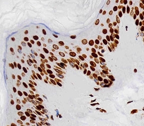 Immunohistochemical analysis of paraffin-embedded human skin section using Histone H4 antibody diluted at 1:25 dilution.
