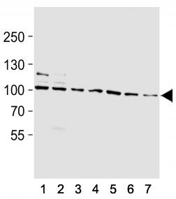 Western blot analysis of lysate from (1) rat L6, (2) mouse NIH3T3, (3) T47D, (4) A2058, (5) HepG2, (6) K562, (7) HeLa cell line using HSP90 antibody at 1:1000.
