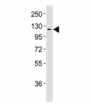 Western blot testing of CSF1R antibodyat 1:2000 dilution + human placenta lysate;