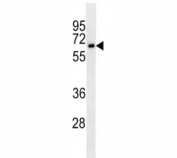 CD25 antibody western blot analysis in Jurkat lysate