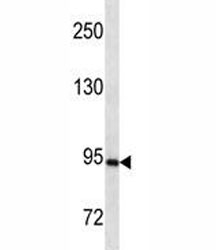 PR antibody western blot analysis in SK-BR-3 lysate. Predicted molecular weight ~99 kDa.