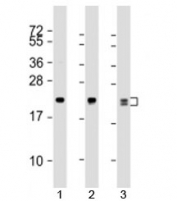 Western blot testing of human 1) MCF7, 2) A431 and 3) A549 cell lysate with RAB13 antibody at 1:1000. Predicted molecular weight: 23 kDa.