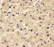 IHC testing of FFPE human liver with PGM1 antibody at 1:25. HIER: steamed in pH6 citrate buffer.