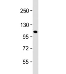 Western blot testing of mouse NIH3T3 cell lysate with GLI1 antibody at 1:2000. Predicted molecular weight: 118 kDa.