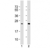 Western blot testing of RAB7L1 antibody at 1:1000-1:2000: Lane 1) human Jurkat and 2) A431 cell lysate. Predicted molecular weight ~23 kDa.