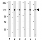 Western blot testing of Myosin Phosphatase antibody at 1:4000: Lane 1) human HEK293, 2) (h) HeLa, 3) (h) HT-29, 4) (h) MCF-7, 5) mouse NIH3T3 and 6) (m) C2C12 cell lysate. Predicted molecular weight ~115 kDa.