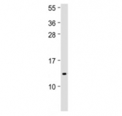 Western blot testing of IFI27 antibody at 1:500 + human spleen lysate. Predicted molecular weight ~11 kDa.
