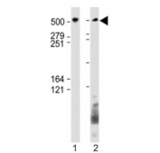 Western blot testing of BIRC6 antibody at 1:1000: Lane 1) huamn SH-SY5Y and 2) HeLa cell lysate. Predicted molecular weight ~530 kDa.