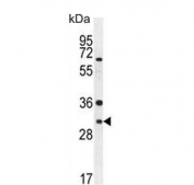 Western blot testing of human A2058 lysate with ARV1 antibody. Predicted molecular weight ~31 kDa.