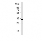 Western blot testing of human Hela lysate with ARV1 antibody. Predicted molecular weight ~31 kDa.