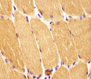 IHC testing of FFPE human skeletal muscle tissue with Dishevelled antibody. HIER: steam section in pH6 citrate buffer for 20 min and allow to cool prior to staining.