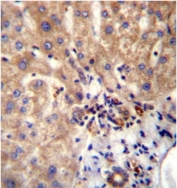 IHC testing of FFPE human liver tissue with Dishevelled antibody. HIER: steam section in pH6 citrate buffer for 20 min and allow to cool prior to staining.