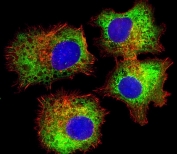 Immunofluorescent staining of fixed and permeabilized human HepG2 cells with Dishevelled antibody (green), DAPI nuclear stain (blue) and anti-Actin (red).