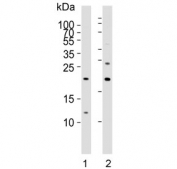 Western blot testing of human 1) A549 and 2) placenta lysate with Epiregulin antibody. Expected molecular weight ~19 kDa.