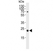 Western blot testing of mouse heart lysate with FOLR2 antibody. Predicted molecular weight ~29 kDa.