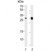 Western blot testing of human 1) MDA-MB-453 and 2) placenta lysate with FOLR2 antibody. Predicted molecular weight ~29 kDa.