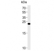 Western blot testing of human SH-SY5Y cell lysate with REG3G antibody. Expected molecular weight: 15-19 kDa.