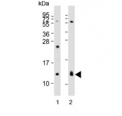 Western blot testing of human 1) kidney and 2) lung lysate with REG3G antibody. Expected molecular weight: 15-19 kDa.