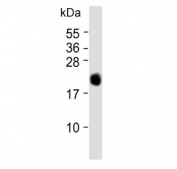 Western blot testing of mouse small intestine lysate with REG3G antibody. Expected molecular weight: 15-19 kDa.
