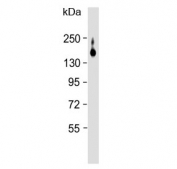 Western blot testing of rat liver lysate with ATP7B antibody. Expected molecular weight: 140-157 kDa.