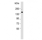 Western blot testing of mouse liver lysate with ATP7B antibody. Expected molecular weight: 140-157 kDa.