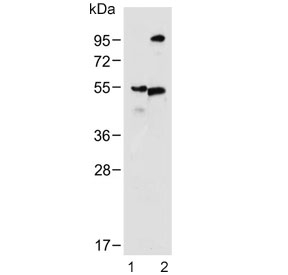 Western blot testing of 1) human skeletal muscle and 2) rat skeletal muscle lysate with MCT4 antibody. Predicted molecular weight ~50 kDa.