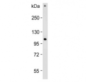 Western blot testing of human HACAT cell lysate with RHBDF2 antibody. Predicted molecular weight ~97 kDa.