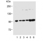 Western blot testing of human 1) A431, 2) HEK293, 3) SK-BR-3, 4) RPMI-8226, 5) MOLT4 and 6) PC-3 cell lysate with ADAMTS17 antibody. Predicted molecular weight ~121 kDa.
