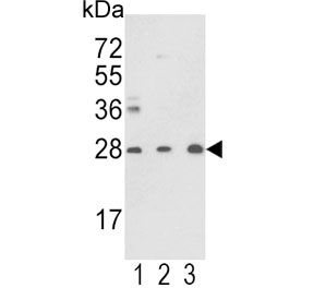 Western blot testing of human 1) Y79, 2) CCRF-CEM and 3) mouse brain lysate with TPI1 antibody. Predicted molecular weight: ~26 kDa.
