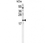 Western blot testing of human K562 cell lysate with Pro-MCH antibody.