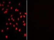Immunofluorescent staining of human HeLa cells with (left) and without (right) PI4K2A antibody (red).