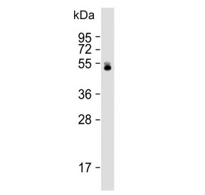 Western blot testing of human liver lysate with UGT2B4 antibody. Predicted molecular weight: 43/46/61 kDa (three isoforms).