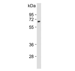 Western blot testing of human cerebellum lysate with UGT2B4 antibody. Predicted molecular weight: 43/46/61 kDa (three isoforms).