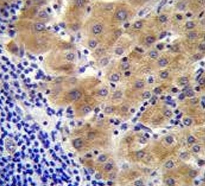 IHC testing of FFPE human liver tissue with Gamma-glutamyl hydrolase antibody. HIER: steam section in pH6 citrate buffer for 20 min and allow to cool prior to staining.