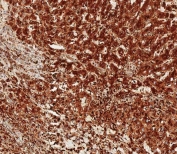 IHC testing of FFPE human liver tissue with Cathepsin D antibody. HIER: steam section in pH9 EDTA for 20 min and allow to cool prior to staining.