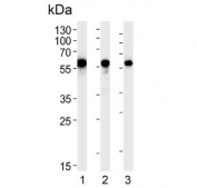 Western blot testing of 1) human HeLa, 2) human SH-SY5Y and 3) rat C6 cell lysate with Calreticulin antibody. Predicted molecular weight ~48 kDa but routinely observed at 55~60 kDa.