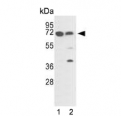 Western blot testing of human 1) A2058 and 2) A375 cell lysate with FKBP10 antibody. Expected molecular weight: 64-78 kDa.