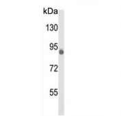 Western blot testing of human K562 cell lysate with Tousled-like kinase 1 antibody. Predicted molecular weight ~87 kDa.