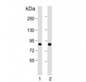 Western blot testing of human 1) A431 and 2) HeLa cell lysate with Tousled-like kinase 1 antibody. Predicted molecular weight ~87 kDa.