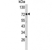 Western blot testing of mouse stomach tissue lysate with ZFP823 antibody. Predicted molecular weight ~70 kDa.