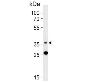 Western blot testing of human K562 cell lysate with Mitoferrin-1 antibody. Predicted molecular weight ~37 kDa.