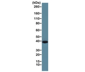 Western blot of human A431 cell lysate using the recombinant GAPDH antibody at 1:1000. Predicted molecular weight ~36 kDa.~