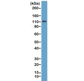 Western blot of human MCF7 lysate using recombinant E-Cadherin antibody at 1:1000. Expected molecular weight: 135 kDa (precursor), 80-120 kDa (mature, depending on gylcosylation level).~