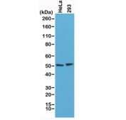 Western blot testing of human HeLa and 293 cell lysate with recombinant PTEN antibody at 1:1000. Expected molecular weight: 47~55 kDa (isoform 1), 65~70 kDa ('long' isoform).