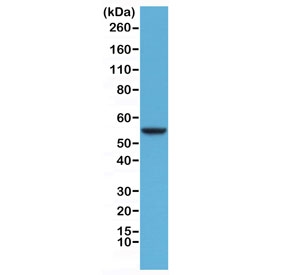 Western blot testing of human HeLa cell lysate with recombinant CK8 antibody at 1:1000. Predicted molecular weight ~56 kDa.~