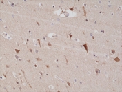 IHC testing of formalin fixed and paraffin embedded human brain tissue with recombinant PSD-95 antibody at 1:200 dilution. HIER: steam section in pH6 citrate buffer for 20 min and allow to cool prior to staining.