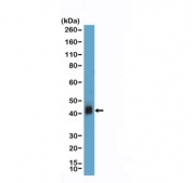 Western blot testing of human Jurkat cell lysate with recombinant CD38 antibody at 1:1000 dilution. Expected molecular weight: 34-46 kDa depending on glycosylation level.